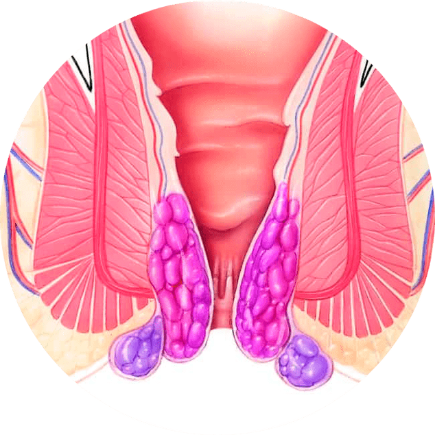 Gelarex soulage les symptômes dès la première utilisation